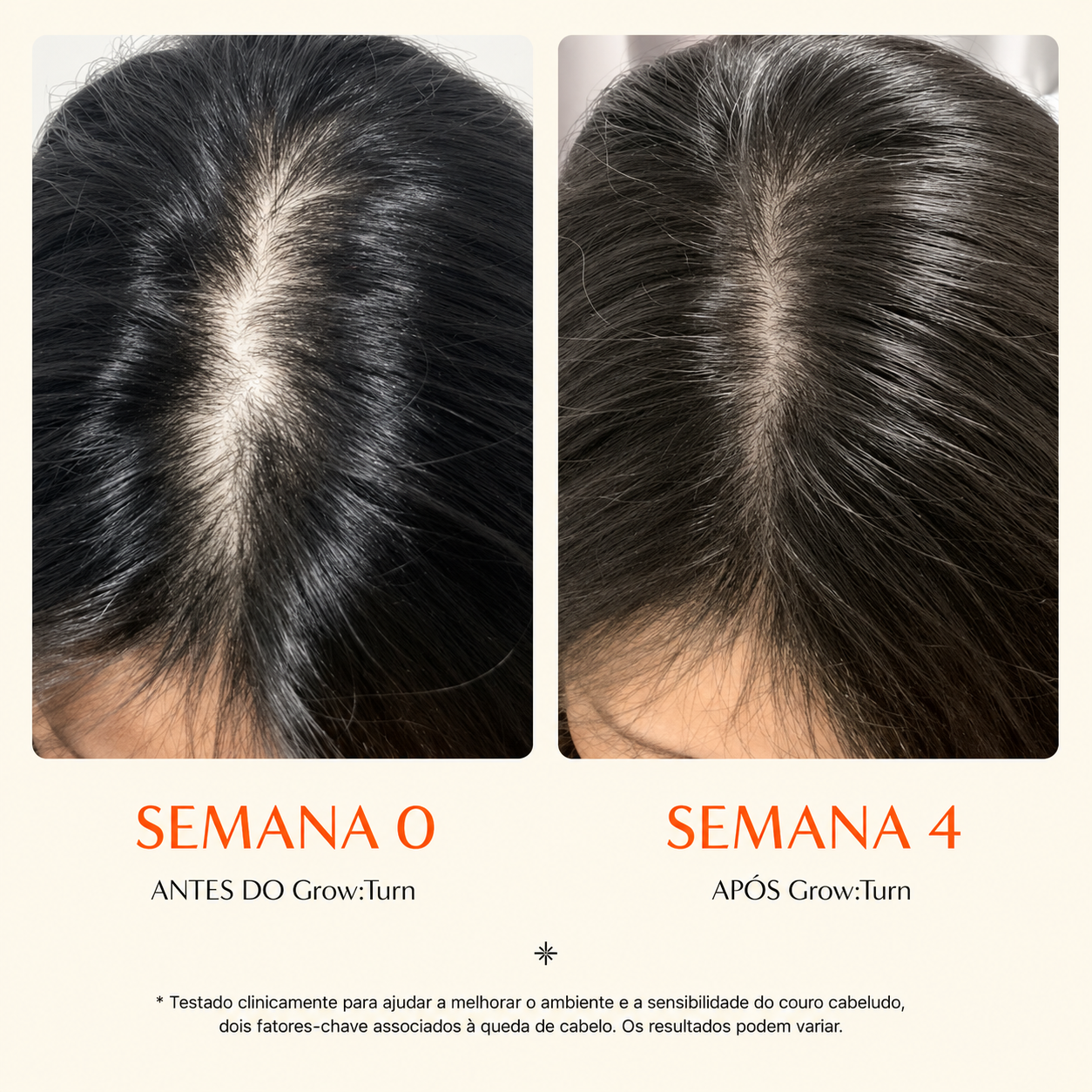 Sérum Capilar Antiqueda Lilyeve Growturn com Aplicador 38 Pontas