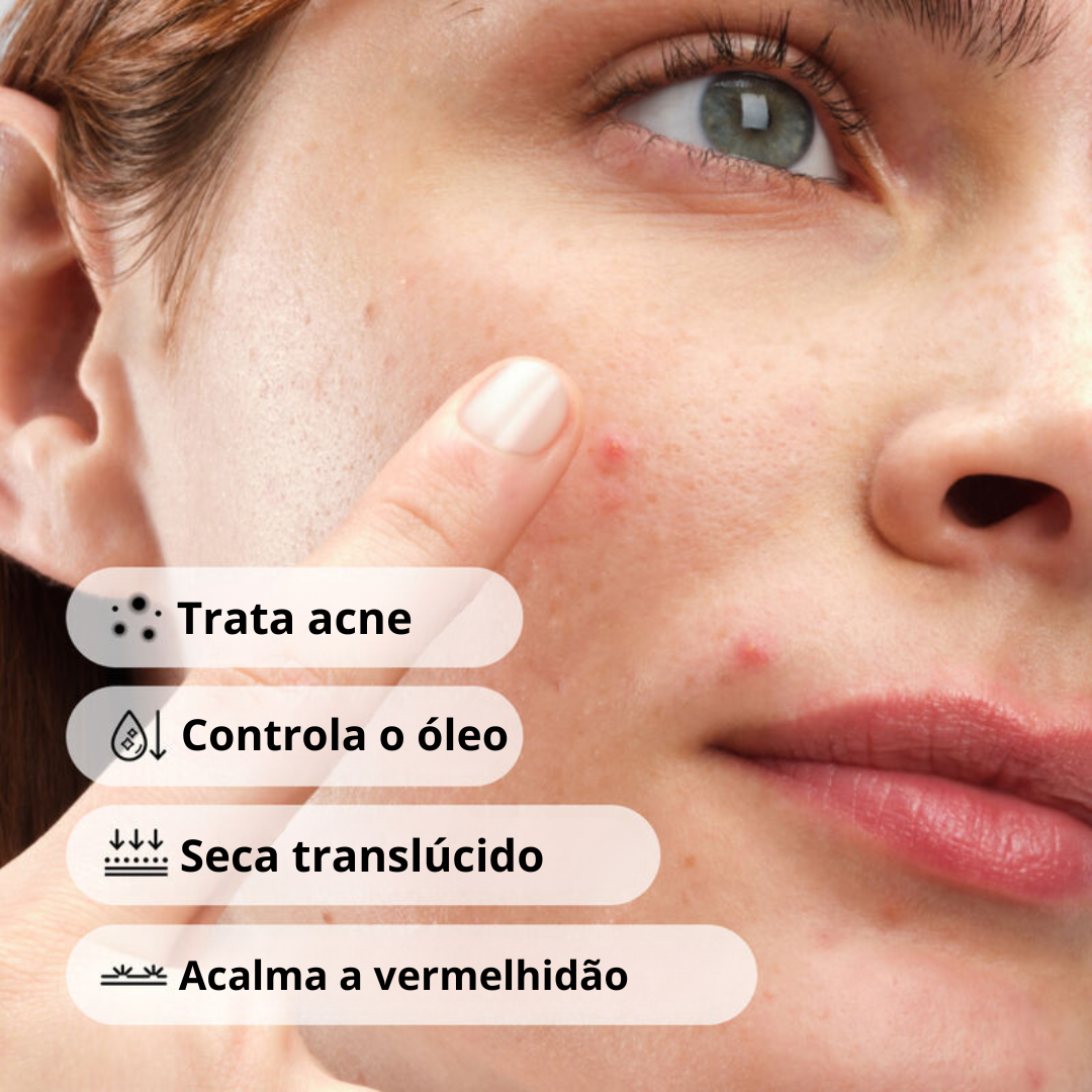 The Ordinary Sulfur 10% Tratamento Antiacne com Enxofre
