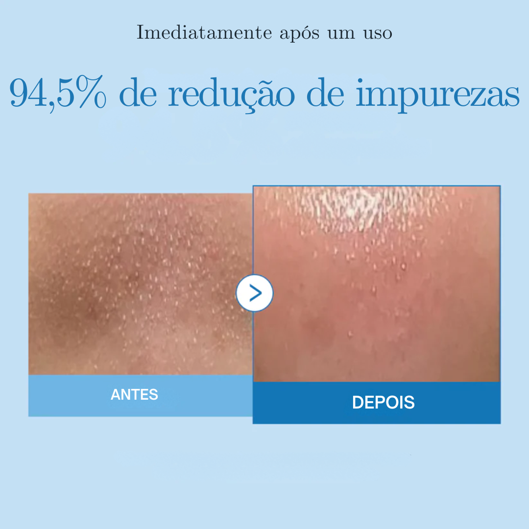 Óleo de Limpeza Medicube Profunda Zero Pore Blackhead