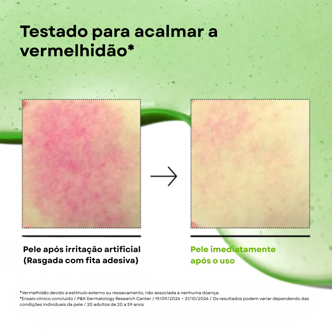 Sérum Anua Calmante com Ácido Azelaico 10% e Ácido Hialurônico