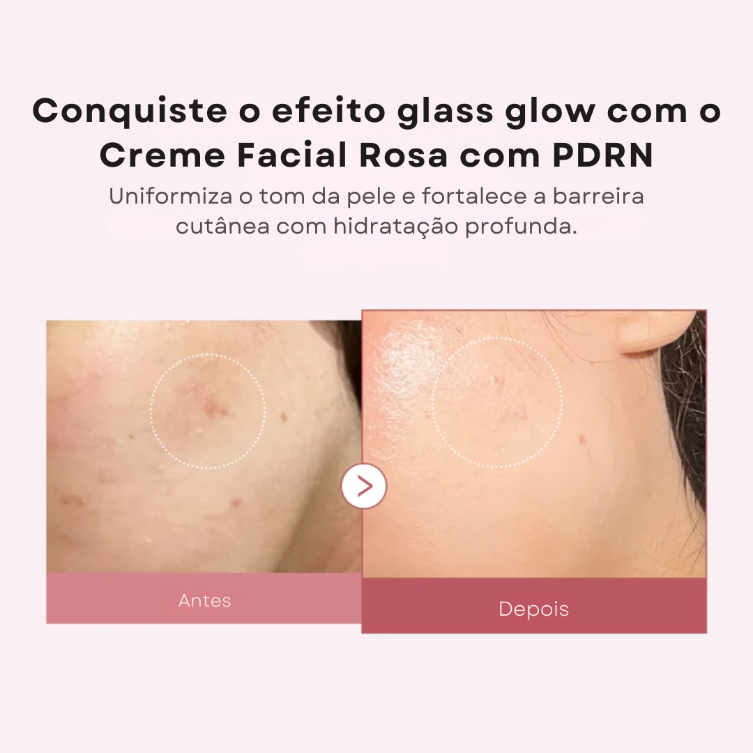 Creme Medicube Pink Hyaluronic PDRN e Peptídeos