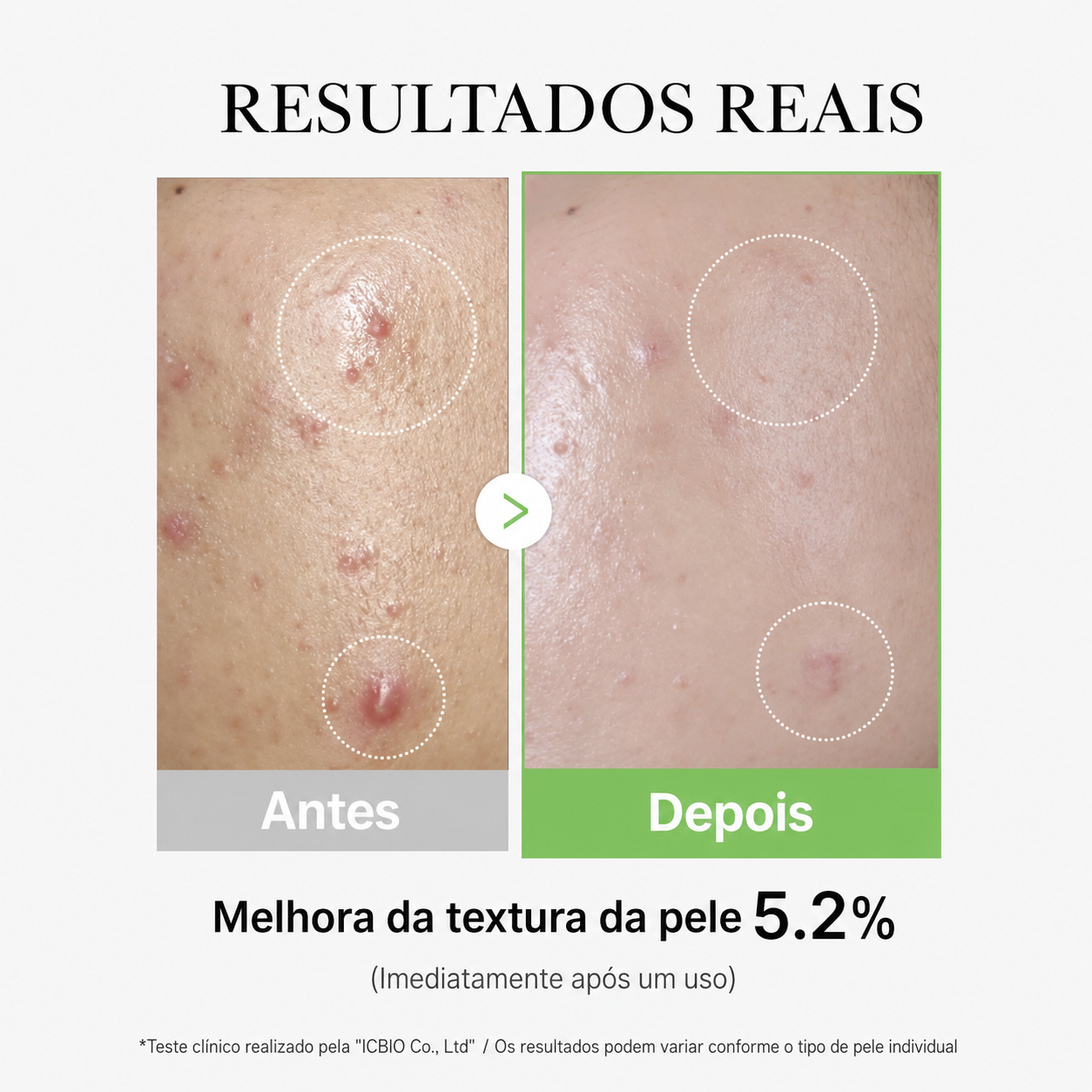 Sérum Calmante Medicube Exosome Cica Ampoule