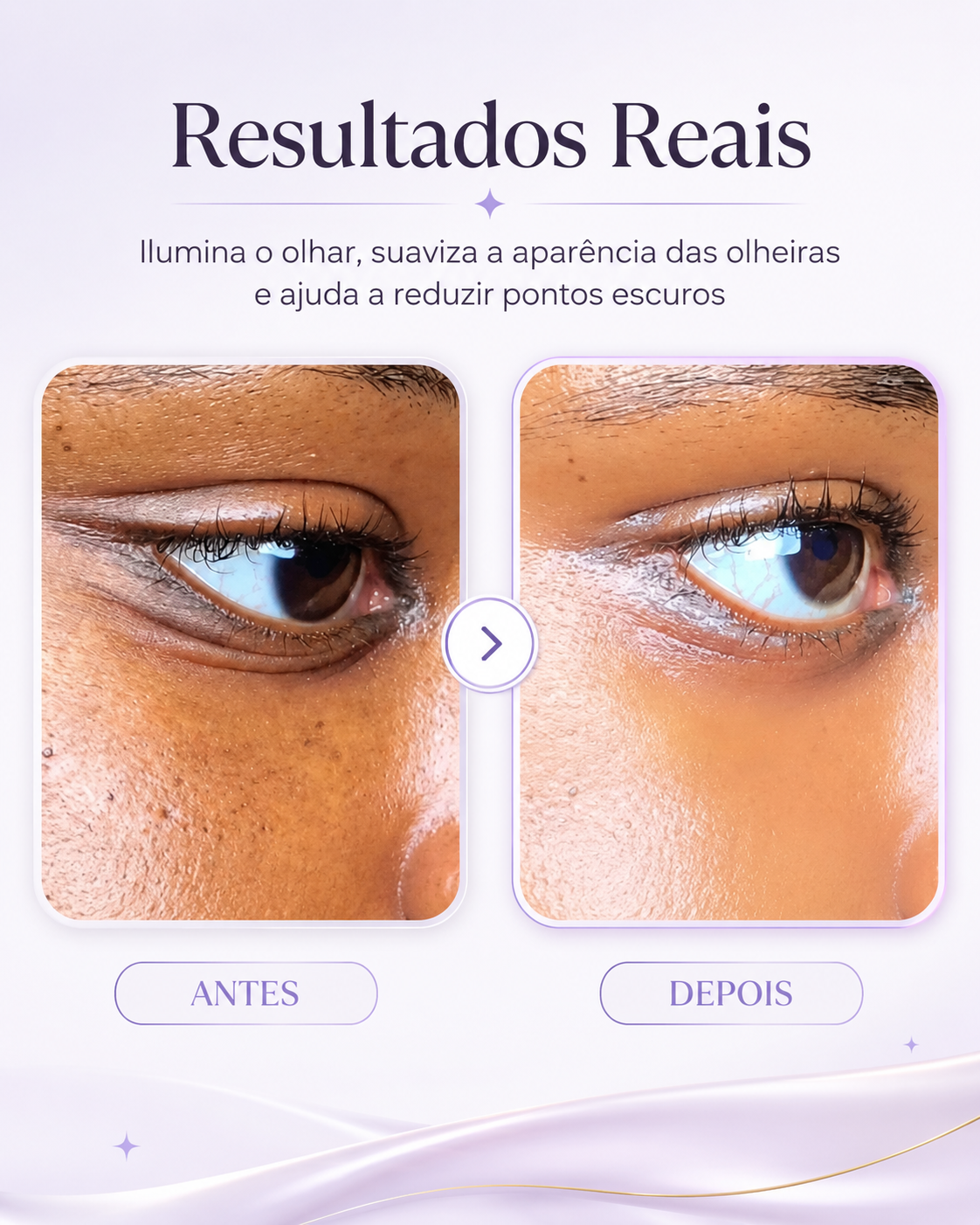 Numbuzin No.9 – NAD+ + Retinol para Olheiras, Rugas e Linhas Finas