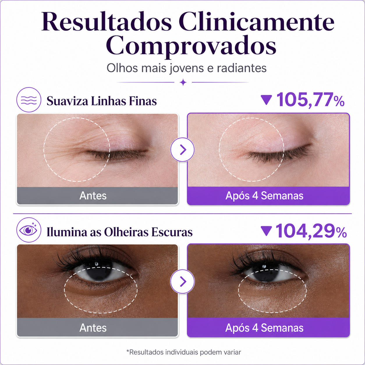 Numbuzin No.9 – NAD+ + Retinol para Olheiras, Rugas e Linhas Finas
