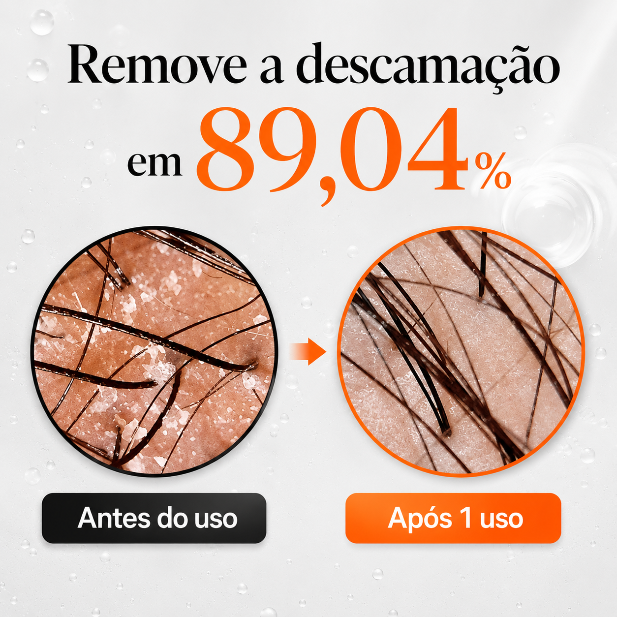 Sérum Capilar Antiqueda Lilyeve Growturn com Aplicador 38 Pontas