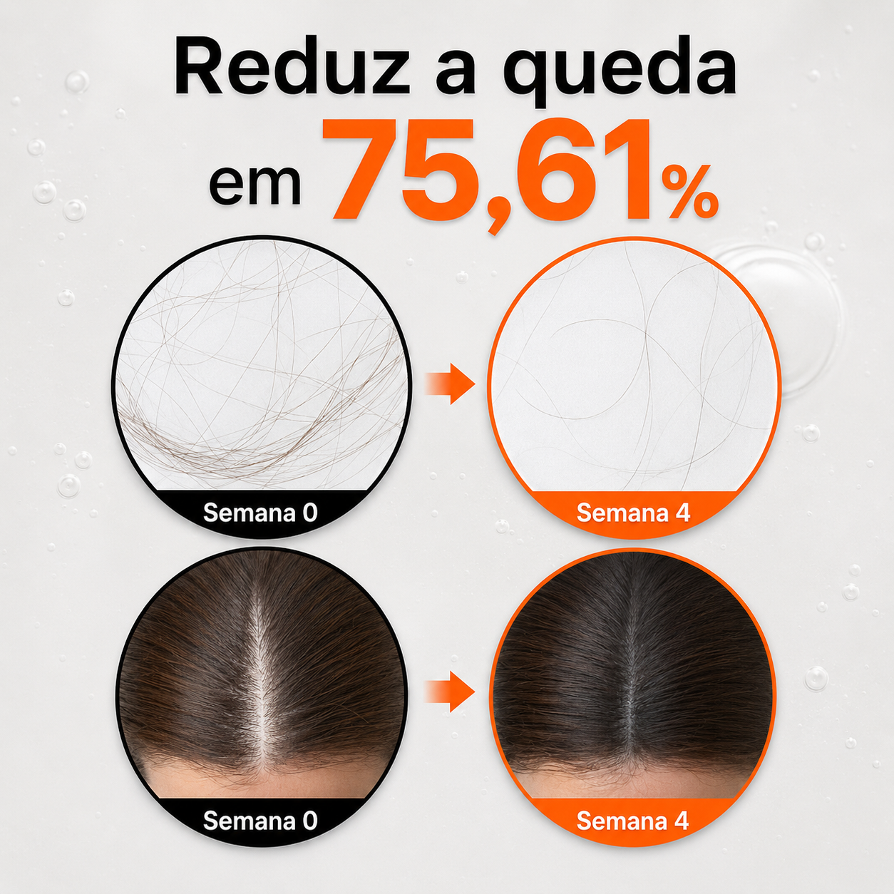 Sérum Capilar Antiqueda Lilyeve Growturn com Aplicador 38 Pontas